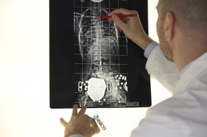 radiografia scoliosi