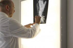 radiografie pazienti scoliosi