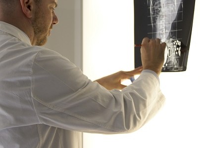 Scoliosi congenite: trattarle come le idiopatiche? Scoliosi congenite: trattarle come le idiopatiche?