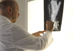 scoliosi radiografia misurazione