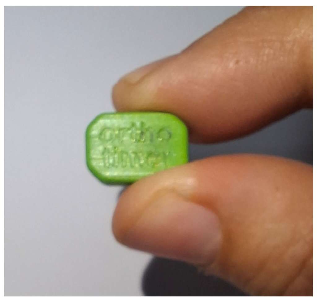 Sensore termico per il monitoraggio dell’aderenza al corsetto nella scoliosi