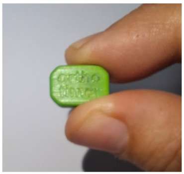 Sensore termico per il monitoraggio dell’aderenza al corsetto nella scoliosi