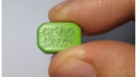 Sensore termico per il monitoraggio dell’aderenza al corsetto nella scoliosi